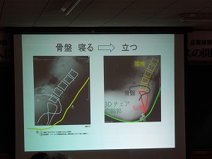 骨盤X線