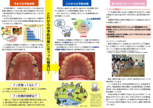 フッ化物洗口