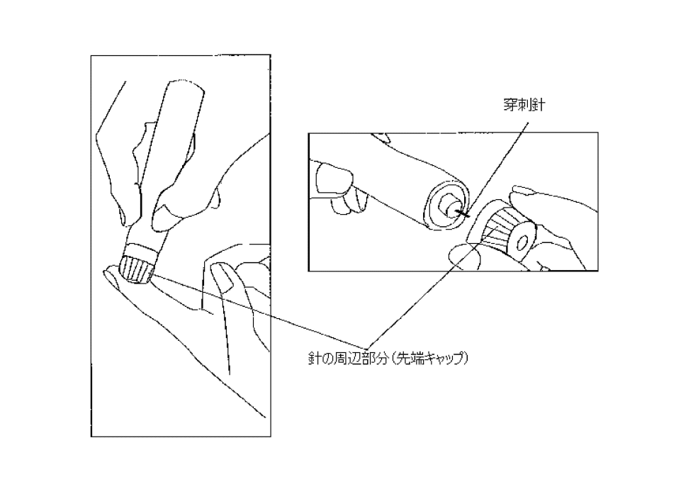 採血用穿刺器具の絵