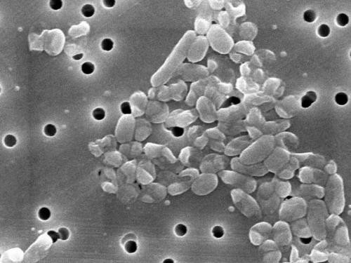 腸炎ビブリオの電子顕微鏡写真です。